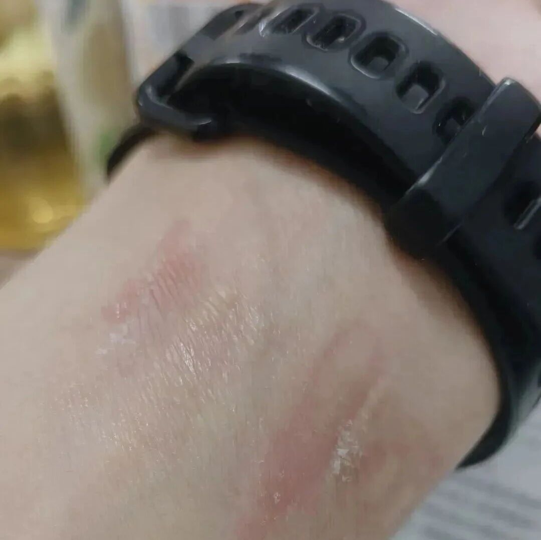 传说中的健康神器?第一批“受害者”已经出现…… 传说中的健康神器?第一批“受害者”已经出现……