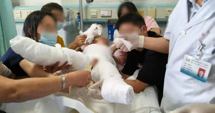 2岁女孩洗澡被单独留在浴室,误触水龙头被70℃热水淋烫2分钟致重度烫伤 2岁女孩洗澡被单独留在浴室,误触水龙头被70℃热水淋烫2分钟致重度烫伤