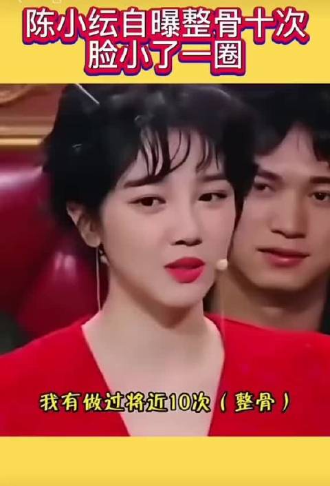 陈小纭曾自曝整骨10次