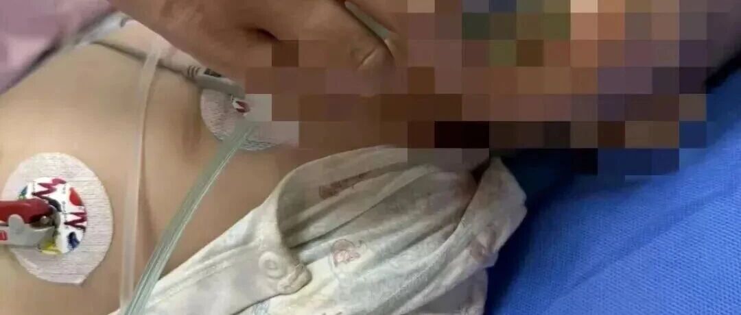 1岁宝宝吃下毒鸡蛋进ICU抢救，警方发现蛋壳上有“细小针孔”，邻居自首，供述目的是“毒黄鼠狼”