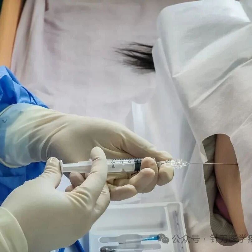 侧隐窝注射针联合针刀疗法治疗腰椎间盘突出症