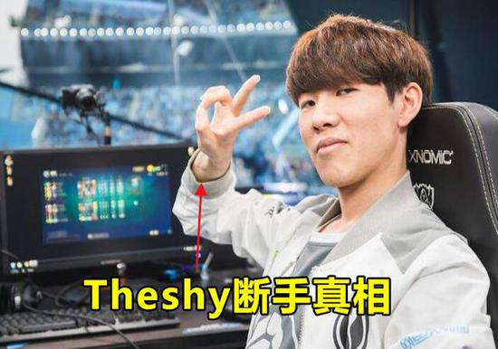 ʦְ Theshyְ ֡ΪIGС