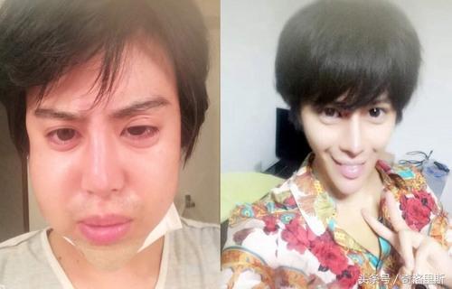 日本整形狂人Allen靠女友资助把自己整成漫画里的美男子。