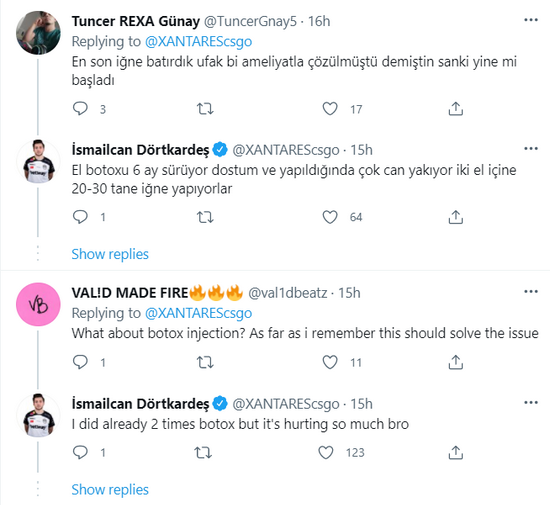 备受困扰 XANTARES欲通过手术解决手汗问题