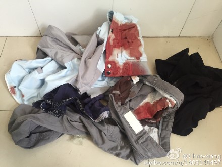 微博用户@Chris-xiang发布的马玺清血衣