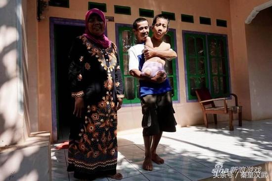 印度男孩没有四肢 却一样可以乐观开心玩游戏