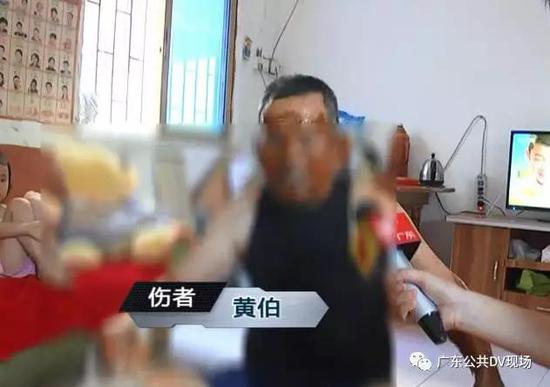 黄伯儿子:两只手都起泡了,脸都黑了,衣服裤子都烂了。