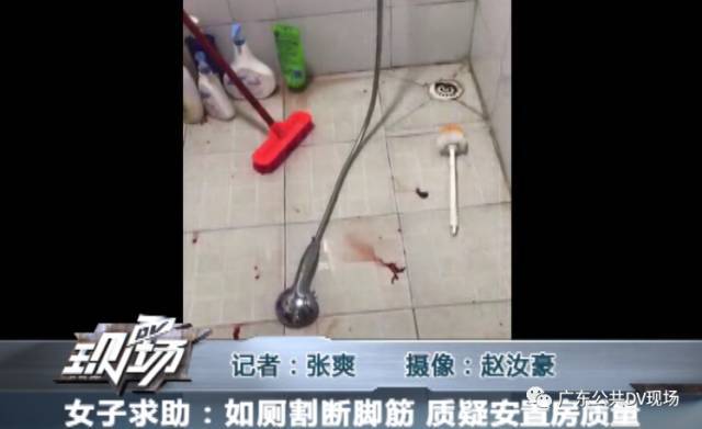 小曾的脚后跟处可以看到明显的断裂,送到医院做了8个小时的手术,才将脚后跟伤处缝合