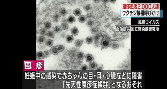 日媒报道风疹疫情