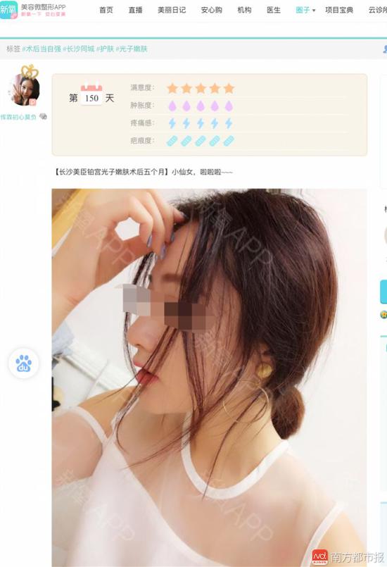 小安的自拍还被用在了医疗美容广告上。