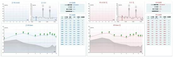 △小晨做的耳声发射，双耳均通过。