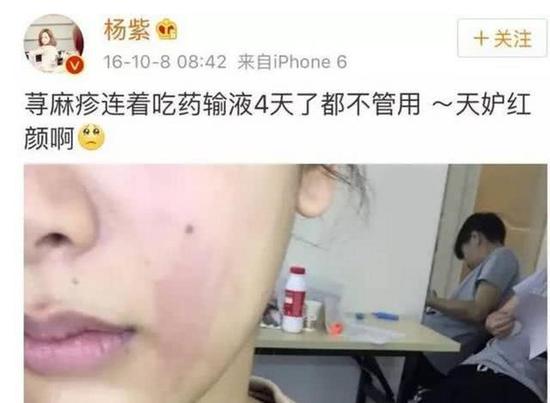 李冰冰一觉醒来,看到自己的脸红成一片,变成了大花猫。