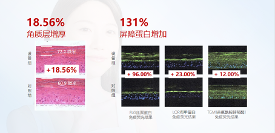 数据来源-博溪通用检测,体外3D表皮皮肤模型功效测试实验,报告号G867-2301057