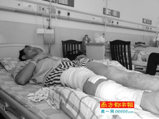 朱飞朋被打断右腿。