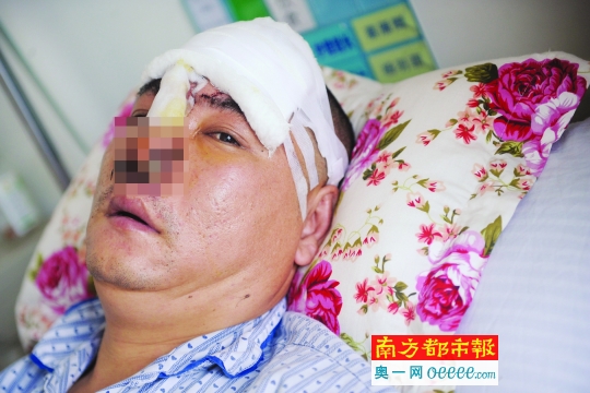 疑打麻将起纠纷 男子鼻子被砍掉