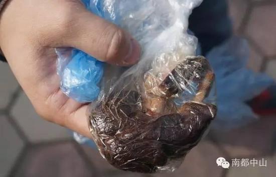 女子产双胞胎后阴道内惊现纱布 医患科长:伤害