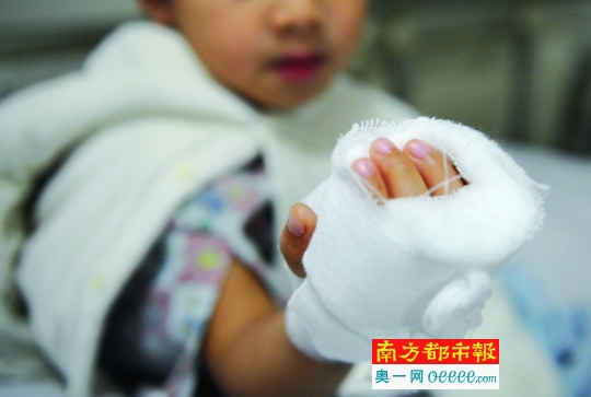 手部缝针后，孩子的手被纱布包裹着。南都记者 叶志文 摄