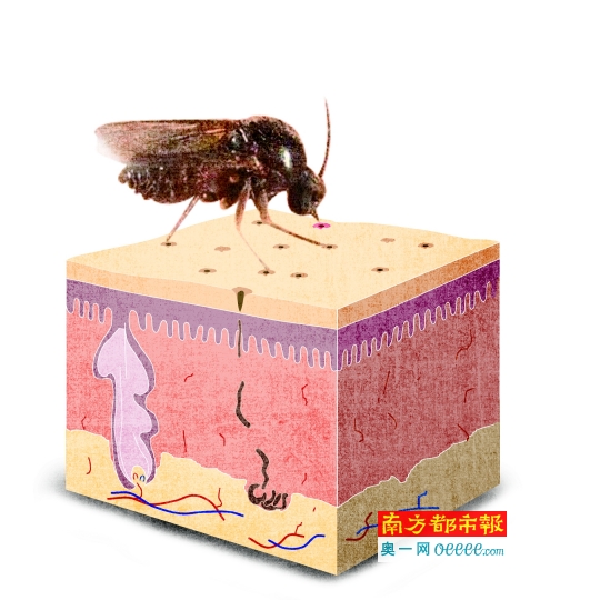 深圳:福田红树林生态公园内虫患严重,尤其蠓虫