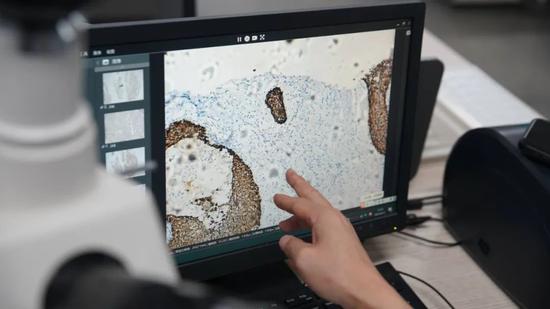 百盛研发染色仪能快速并准确地诊断癌细胞扩散情况