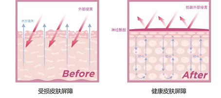 受损皮肤屏障&健康肌肤屏障对比