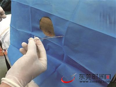 医生正在为罗女士打麻醉针