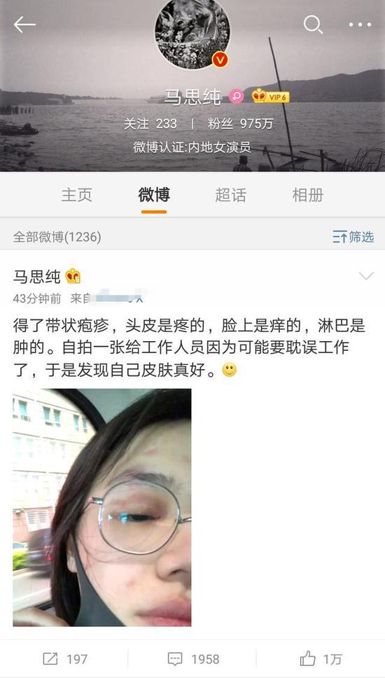 马思纯得带状疱疹,满脸斑点眼睛红肿,发文调侃:皮肤真好