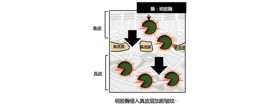 明胶酶侵入真皮层加剧皱纹