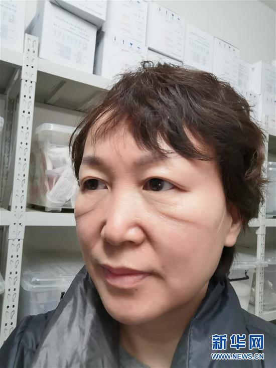 武汉大学人民医院感染科护士长谌利琴穿了一天防护服后,口罩的印迹清晰可见(2月1日摄)。新华社发