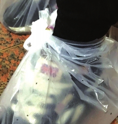 贵阳一小区跳蚤成灾出门需 全副武装 市民苦不