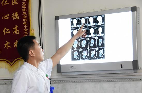 解放军425医院医生讲解男童病情