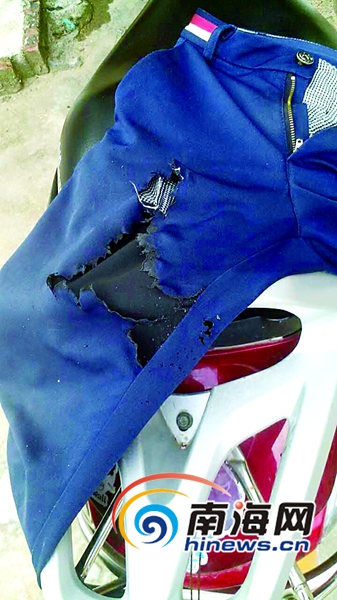 小赵被烧破的裤子。