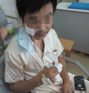 ▲被歹徒袭击的的哥王师傅