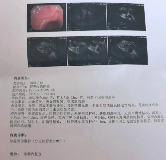 郭女士的检查报告单