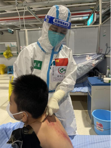 　　（刮痧，利用患者随身携带的银梳子，便给患儿头部、背部阳脉刮痧以疏通经络，振奋阳气，祛邪外出，缓解发烧症状。）