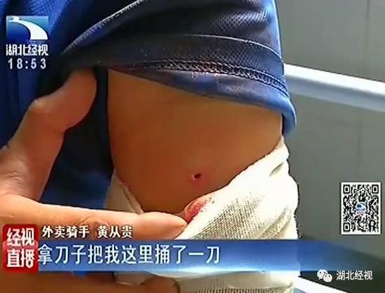 （黃師傅被捅的手臂，袖子被血濡濕）