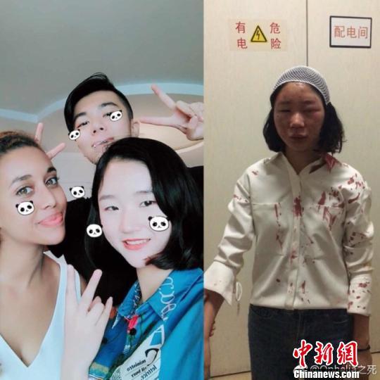 图为当事人提供的被打前后对比图。 网络图