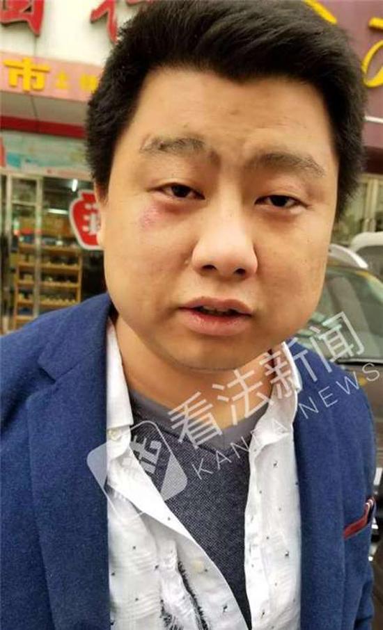 被打律师王志伟在事发现场。 本文图片均来自看法新闻