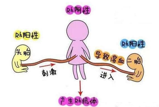 “熊猫血”产妇二胎溶血高风险示意图