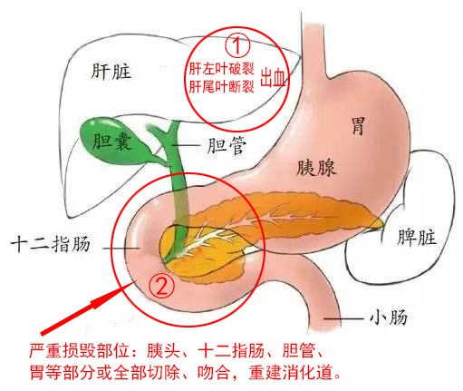 腹腔多脏器示意图