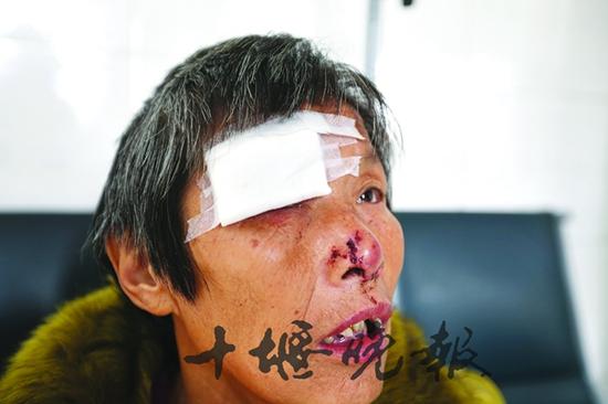 25日下午，一只白色流浪狗在鄖陽區(qū)城關(guān)鎮(zhèn)接連咬傷十余人。