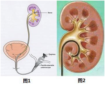 O7RG-fykcppy0602269.png