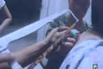 湖北一市民拔火罐取不下來 消防員化險為夷