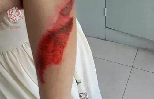 女博士被人猛推一掌滚下几十级台阶
