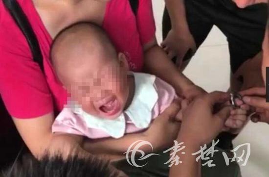 男童被铁环套住,无法取下