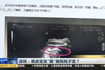 寶寶“踹”破媽媽子宮？ 子宮手術(shù)留疤暗藏妊娠風(fēng)險(xiǎn)