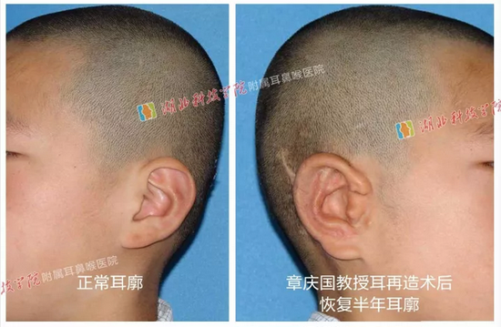 图一