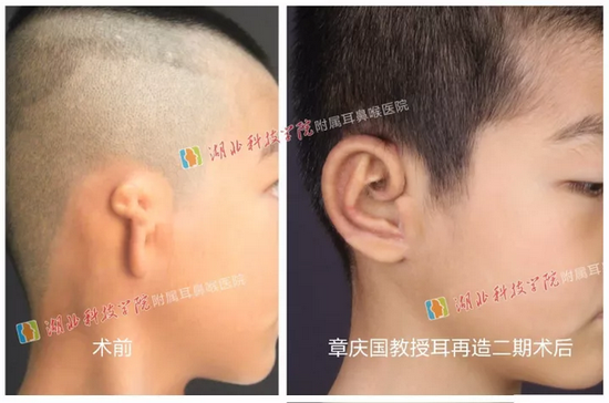 图二