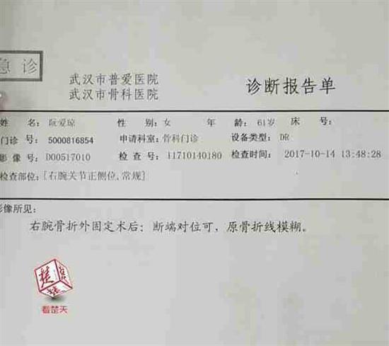 女子旅游時摔倒骨折