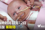 早產(chǎn)女嬰心臟長在胸腔外 手術(shù)后奇跡存活