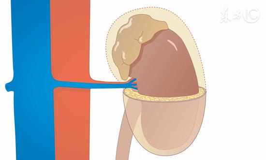肾脏有“三怕”